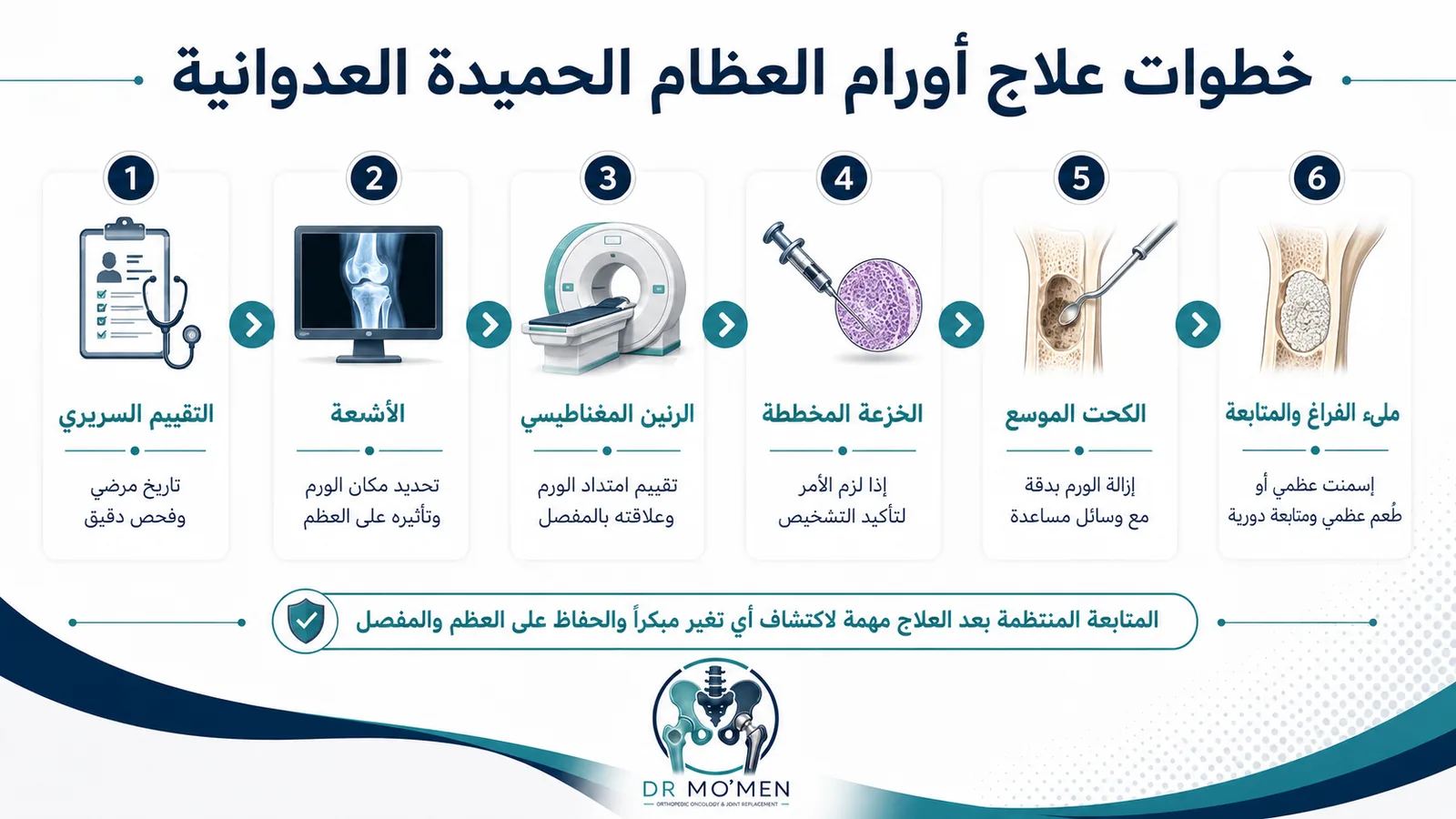 خطوات علاج أورام العظام الحميدة العدوانية من التشخيص إلى الكحت الموسع والمتابعة