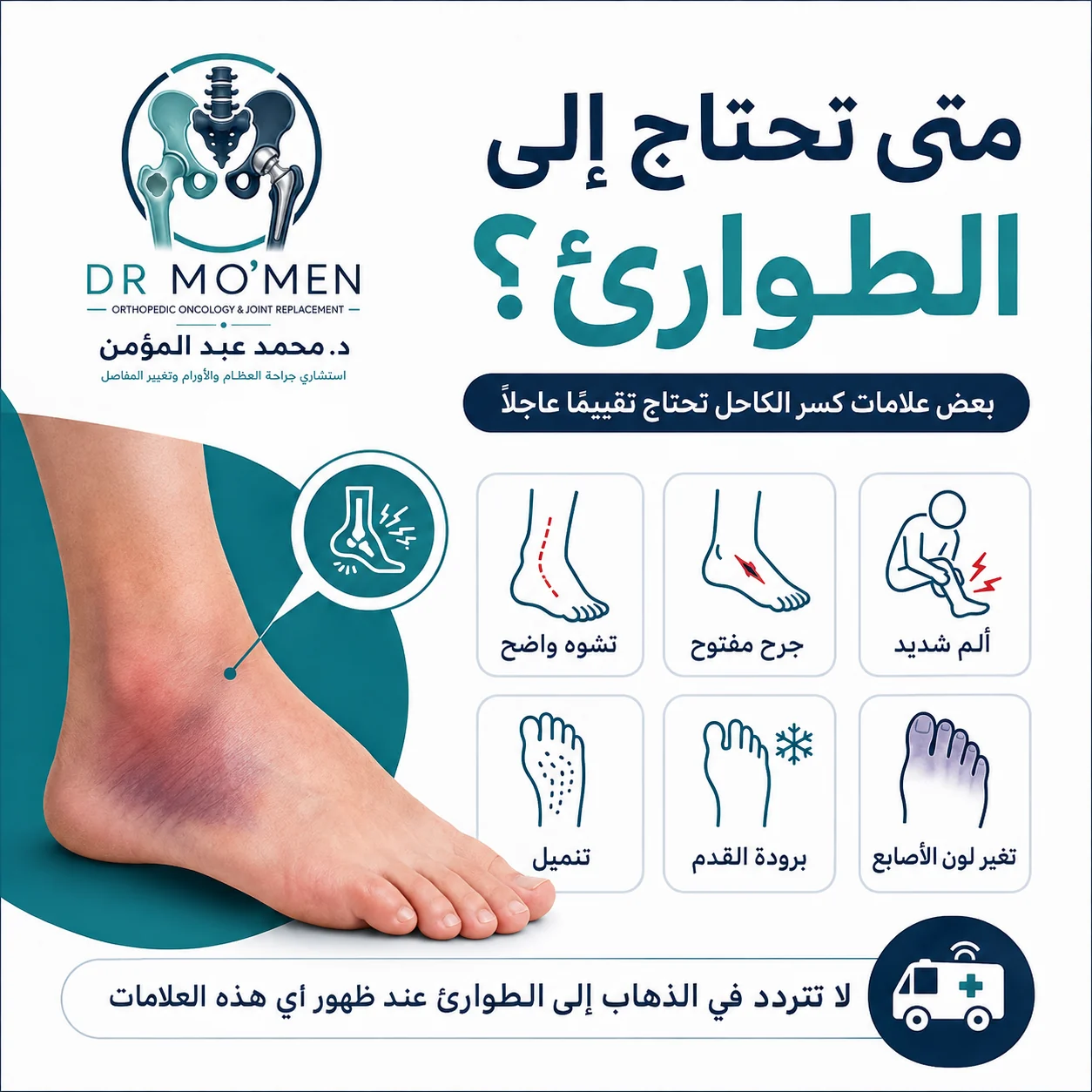إنفوجراف طبي يوضح علامات الخطر بعد كسر الكاحل