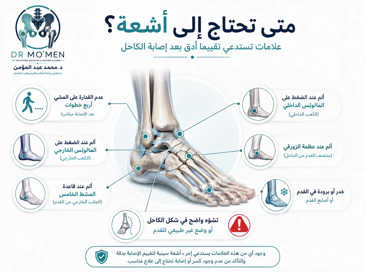 رسم طبي يوضح علامات الخطر التي تستدعي الأشعة بعد التواء الكاحل