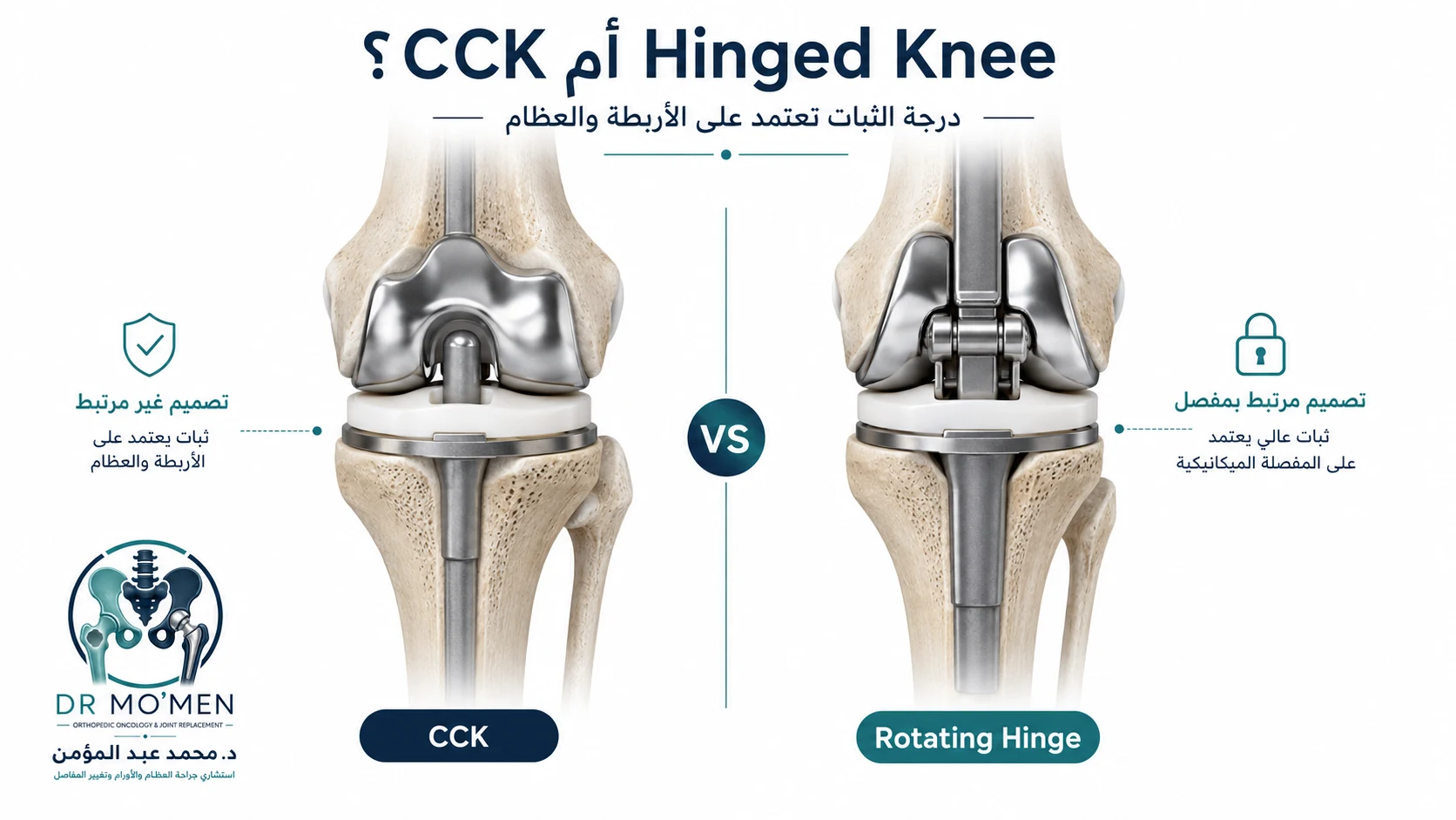 رسم طبي تعليمي يقارن بين مفصل الركبة CCK والمفصل Rotating Hinge في جراحات الركبة المعقدة.