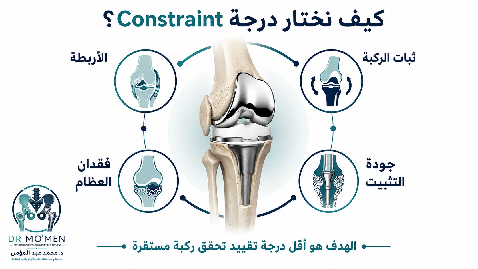 إنفوجرافيك يوضح دور الأربطة وثبات الركبة وفقدان العظام وجودة التثبيت في اختيار درجة التقييد.