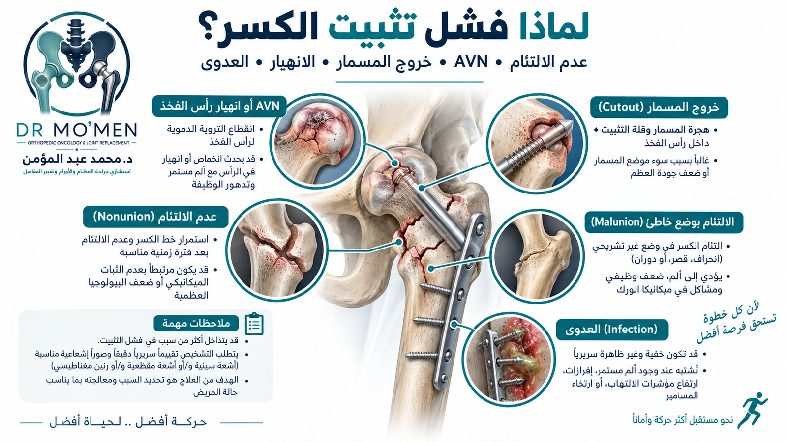 لماذا فشل تثبيت الكسر؟ إنفوجرافيك طبي يوضح أسباب فشل تثبيت كسر أعلى الفخذ مثل عدم الالتئام والنخر اللاوعائي وخروج المسمار والعدوى.