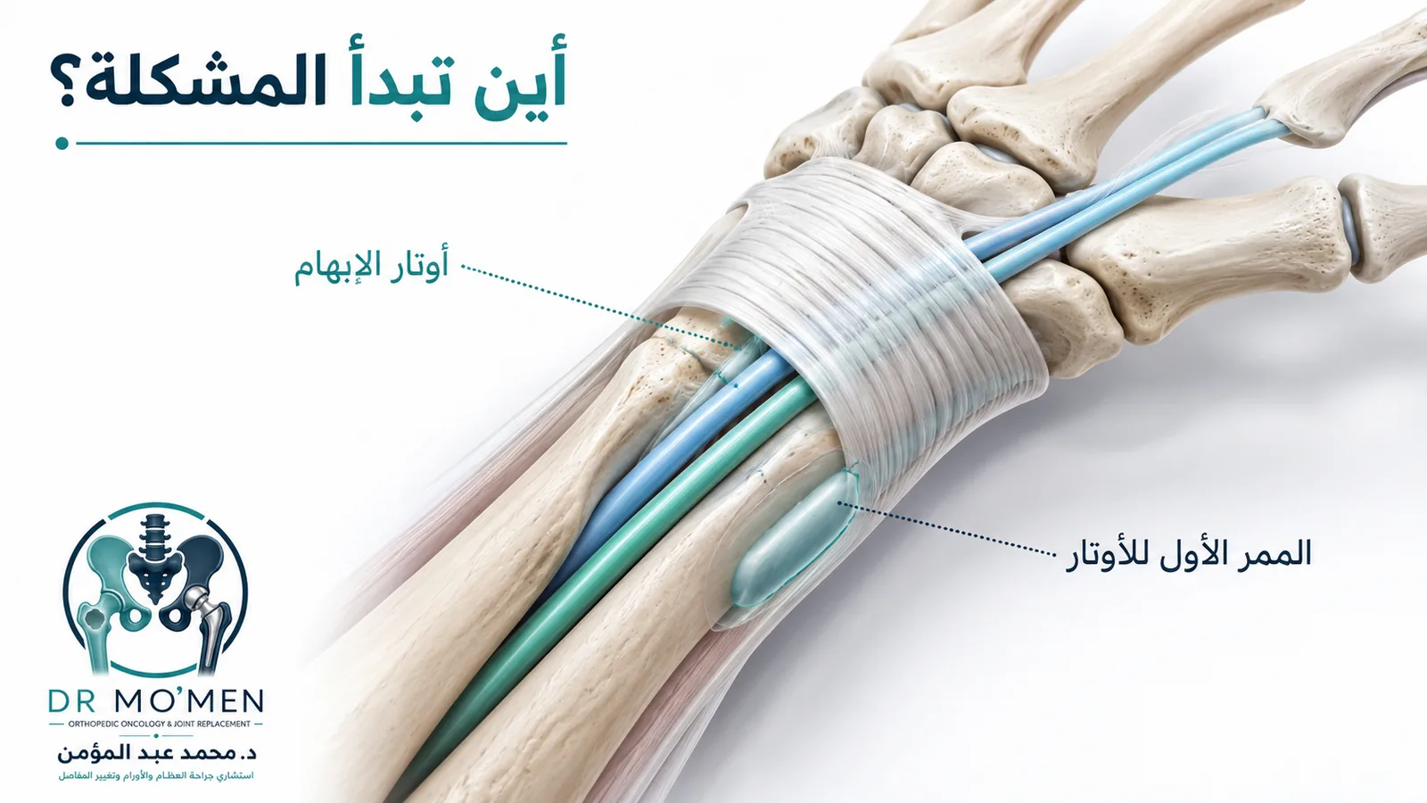 تشريح طبي يوضح أوتار APL وEPB داخل الممر الأول عند جانب الرسغ.