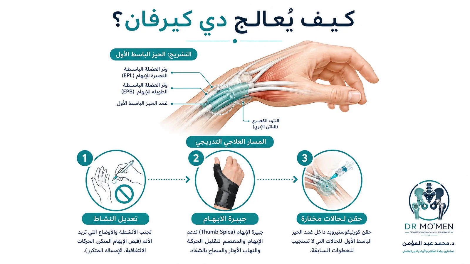 إنفوجرافيك يوضح علاج دي كيرفان بتعديل النشاط وجبيرة الإبهام والحقن في الحالات المختارة.