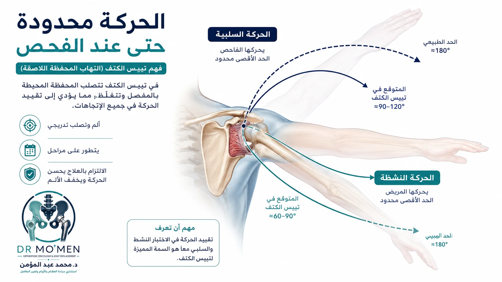 إنفوجرافيك يوضح أن الحركة النشطة والحركة السلبية تكونان محدودتين في الكتف المتجمد.