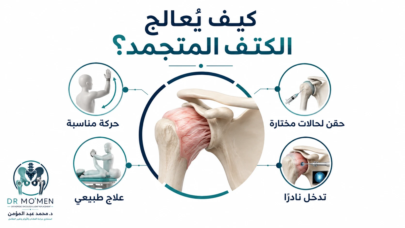 إنفوجرافيك يوضح علاج الكتف المتجمد بالحركة المناسبة والعلاج الطبيعي والحقن في حالات مختارة والتدخل نادرًا.