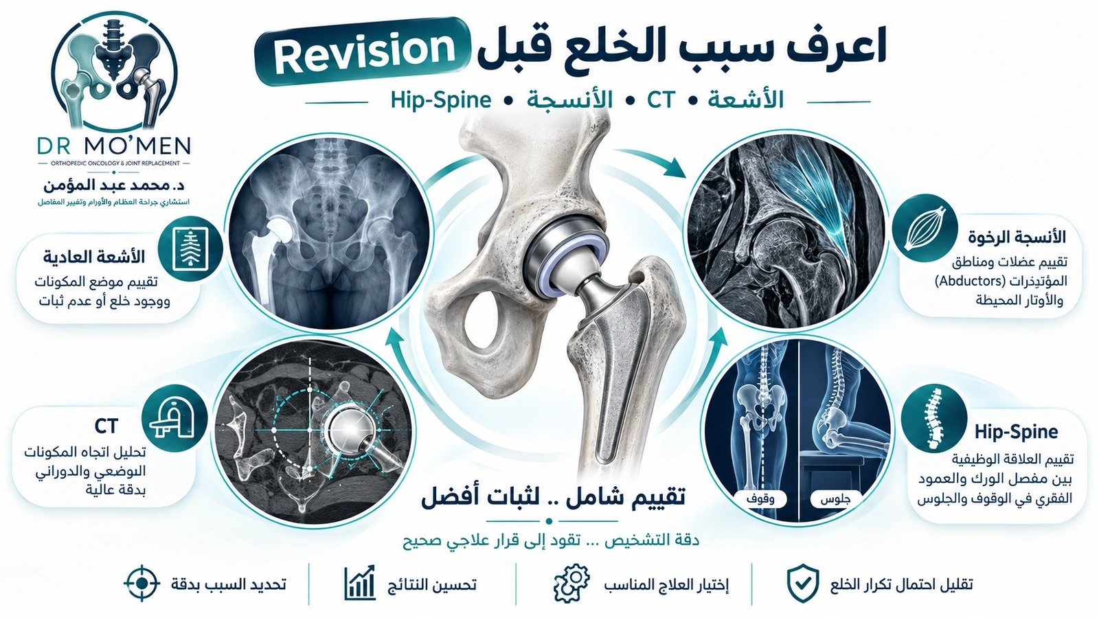 إنفوجرافيك يوضح الأشعة وCT وتقييم الأنسجة وحركة الحوض والعمود الفقري قبل Revision لمفصل الفخذ غير المستقر.