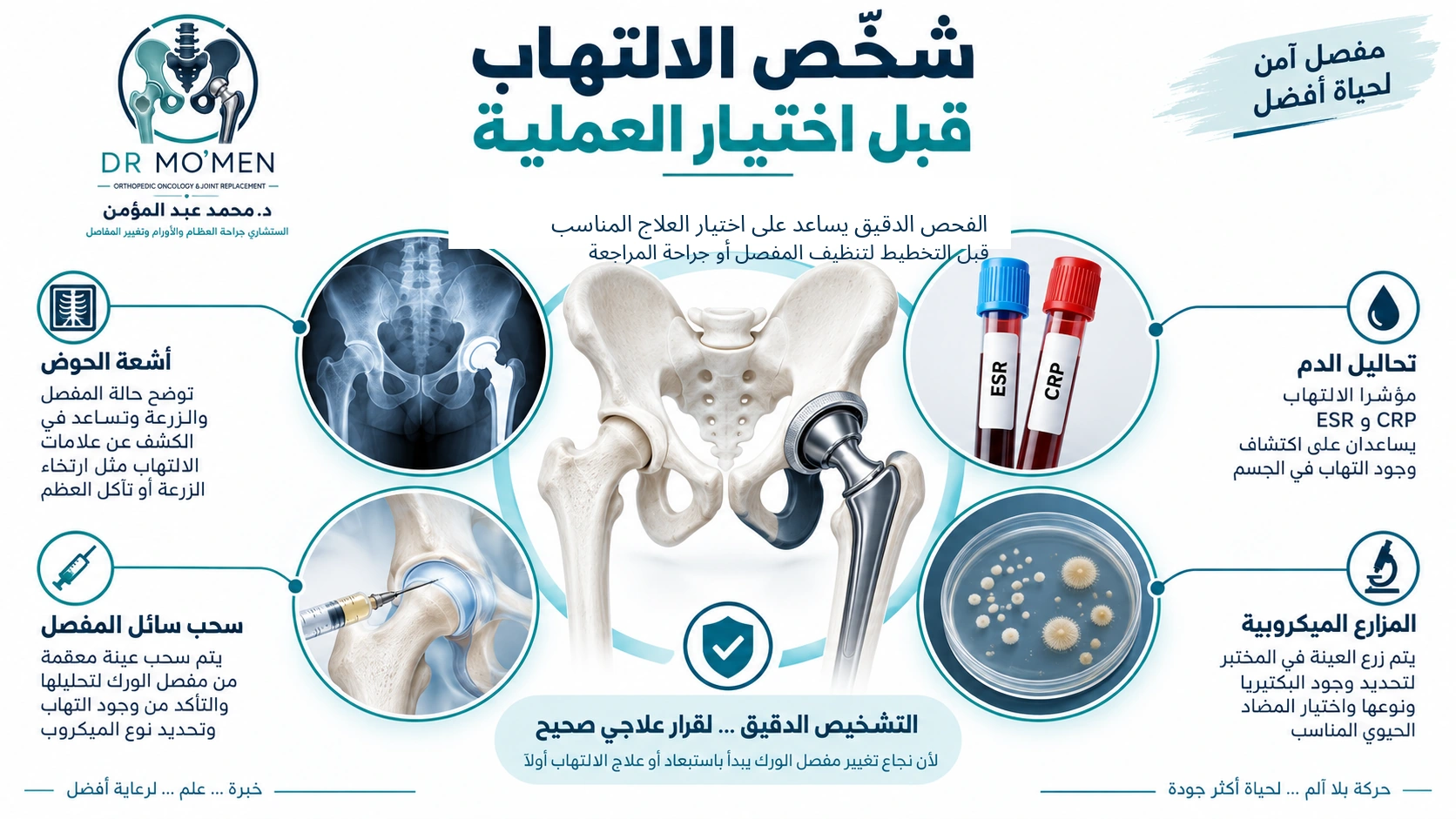 إنفوجرافيك يوضح الأشعة وتحاليل ESR وCRP وسحب عينة المفصل والمزارع لتقييم التهاب مفصل الفخذ الصناعي.