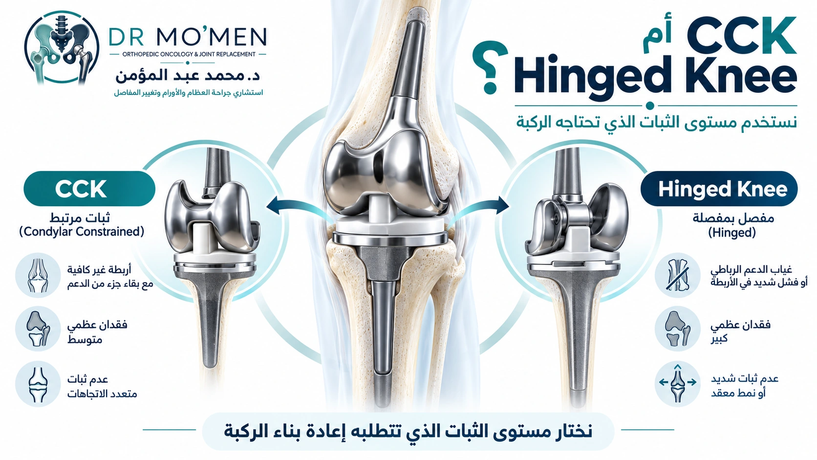 CCK أم Hinged Knee؟ رسم طبي يوضح أن اختيار CCK أو Hinged Knee يعتمد على حالة الأربطة والعظام ودرجة عدم الثبات.