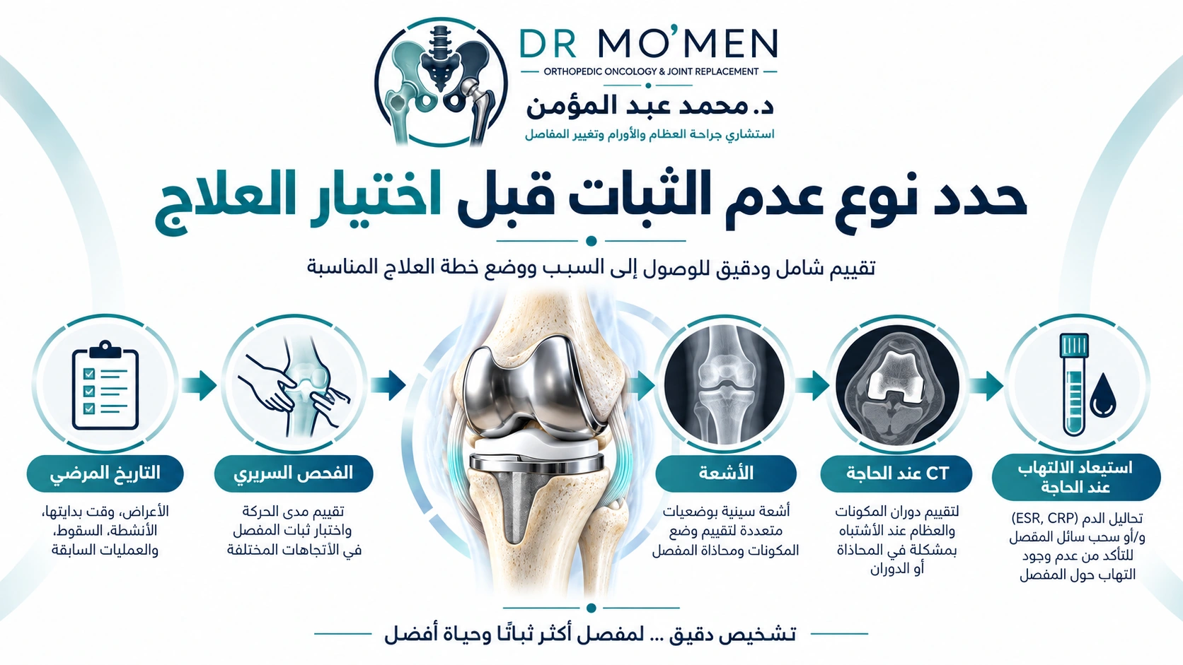 حدد نوع عدم الثبات قبل اختيار العلاج إنفوجرافيك يوضح خطوات تقييم عدم ثبات مفصل الركبة الصناعي قبل اختيار العلاج.