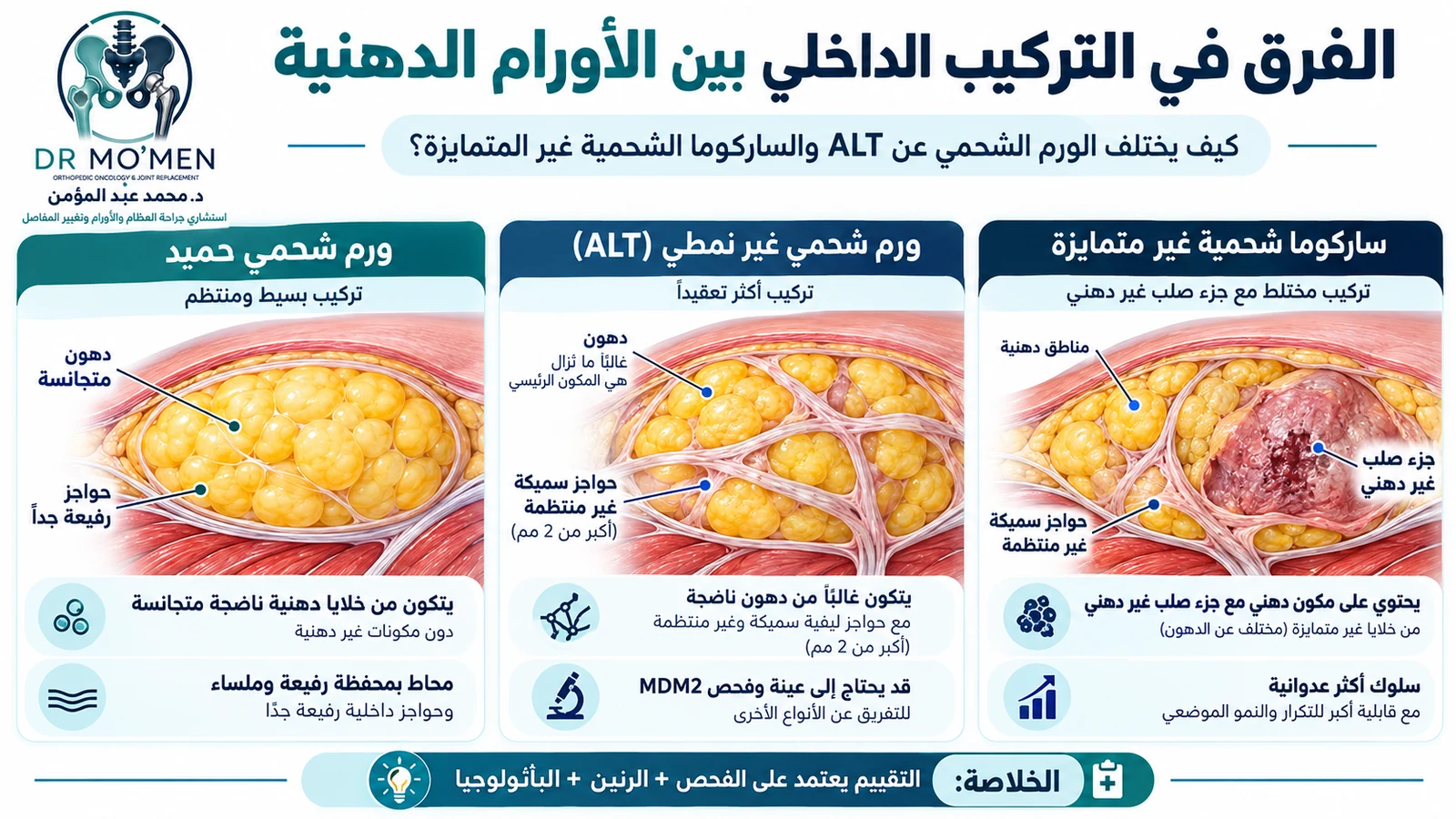 مقارنة تعليمية بين الورم الشحمي الحميد والورم الشحمي غير النمطي ALT والساركوما الشحمية.