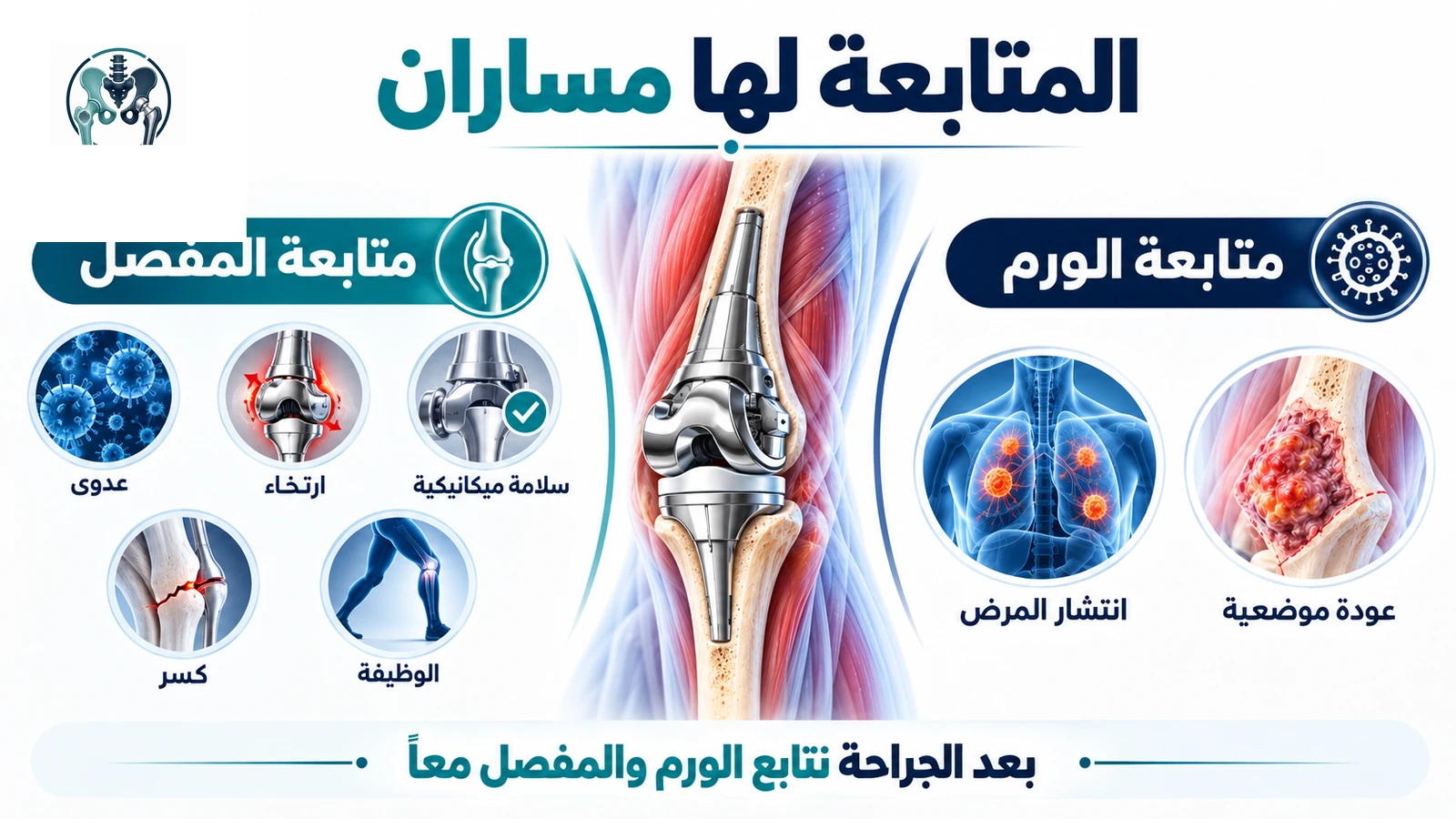 إنفوجرافيك يوضح متابعة الورم ومتابعة المفصل الصناعي والوظيفة والمضاعفات بعد الجراحة