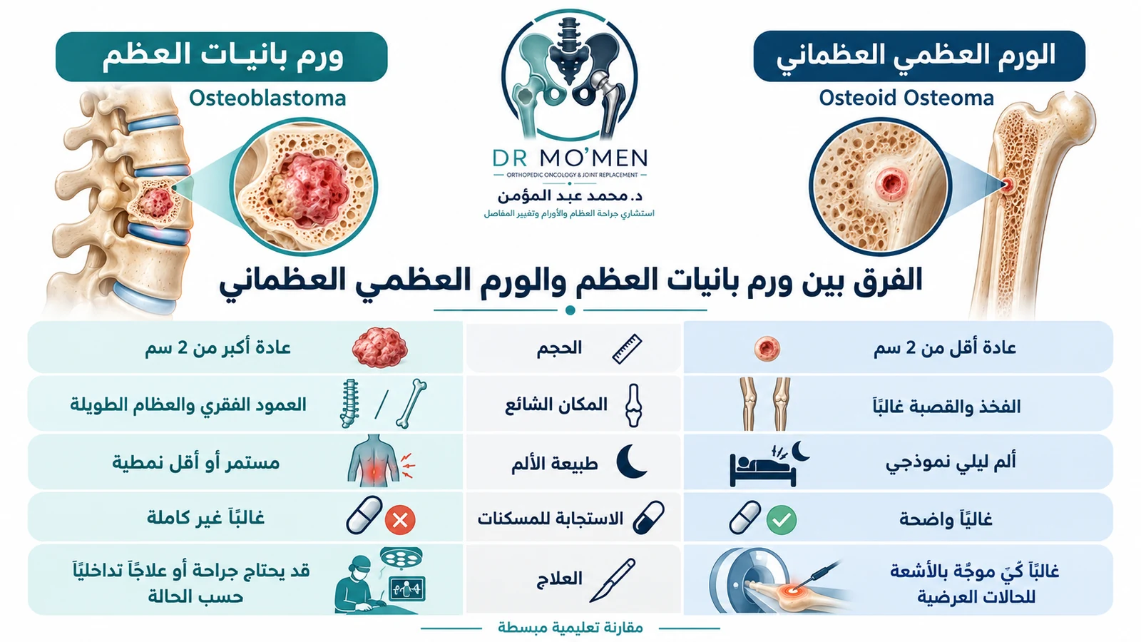 إنفوجرافيك طبي يقارن بصورة مبسطة بين ورم بانيات العظم والورم العظمي العظماني من حيث الحجم والمكان والألم والاستجابة للمسكنات والعلاج.