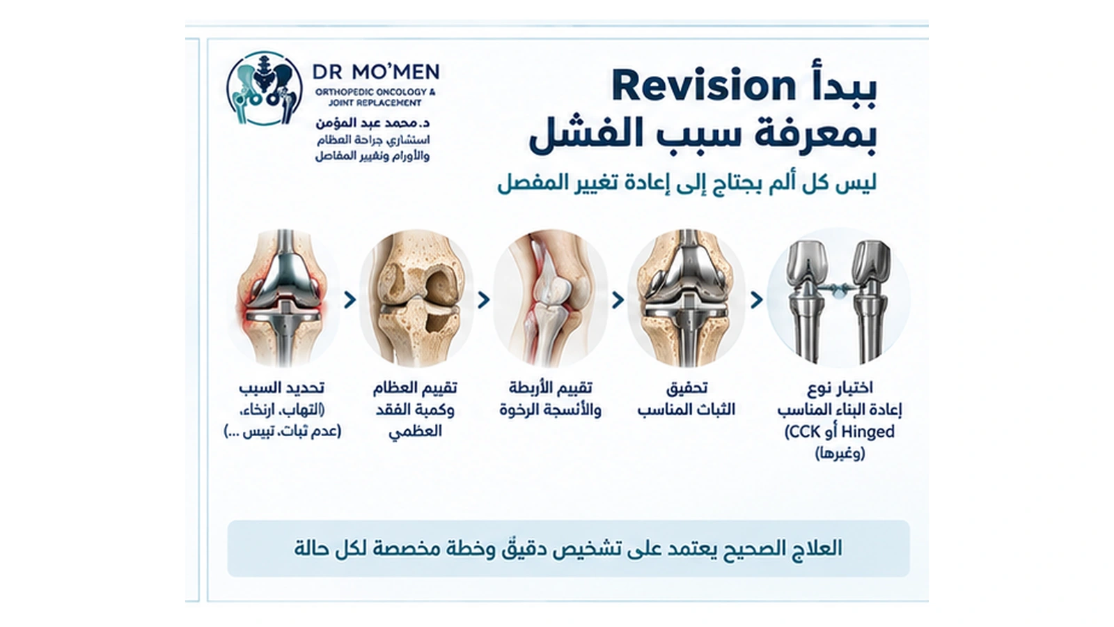 Revision يبدأ بمعرفة سبب الفشل إنفوجرافيك يوضح أن جراحة إعادة تغيير مفصل الركبة تعتمد على تشخيص سبب الفشل وتقييم العظام والأربطة قبل اختيار نوع المفصل.