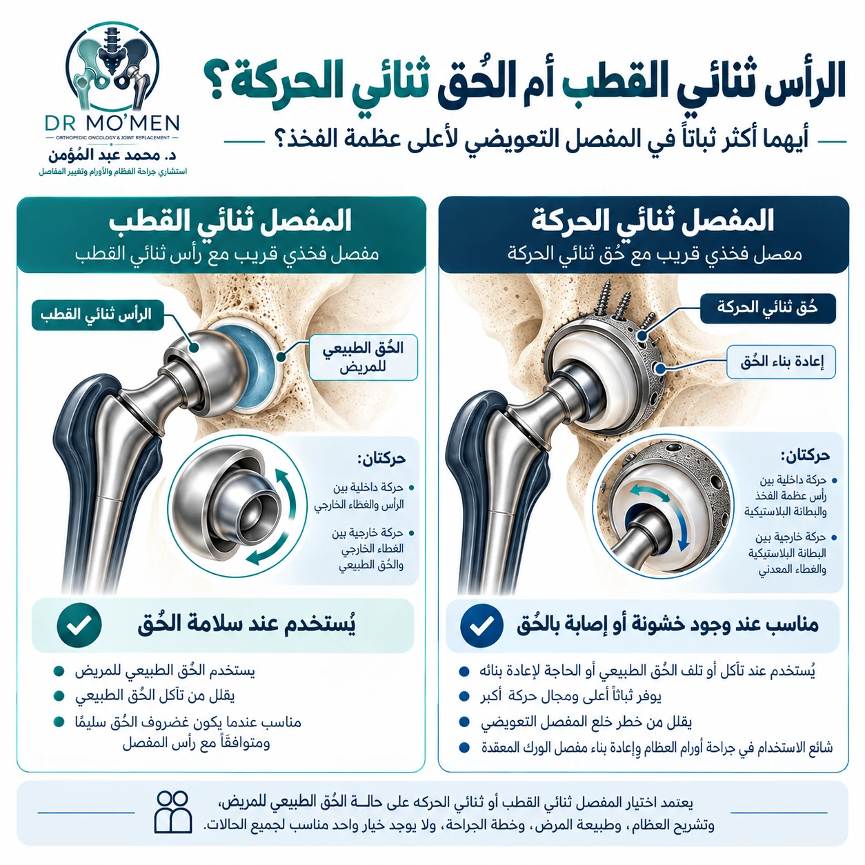 مقارنة تعليمية بين الرأس ثنائي القطب والحُق ثنائي الحركة في المفصل التعويضي لأعلى عظمة الفخذ.