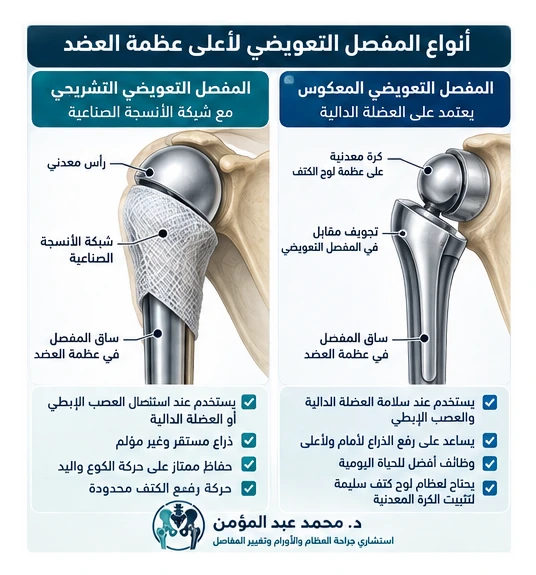 مقارنة تعليمية بين المفصل التعويضي التشريحي والمفصل التعويضي المعكوس بعد استئصال أورام أعلى عظمة العضد.