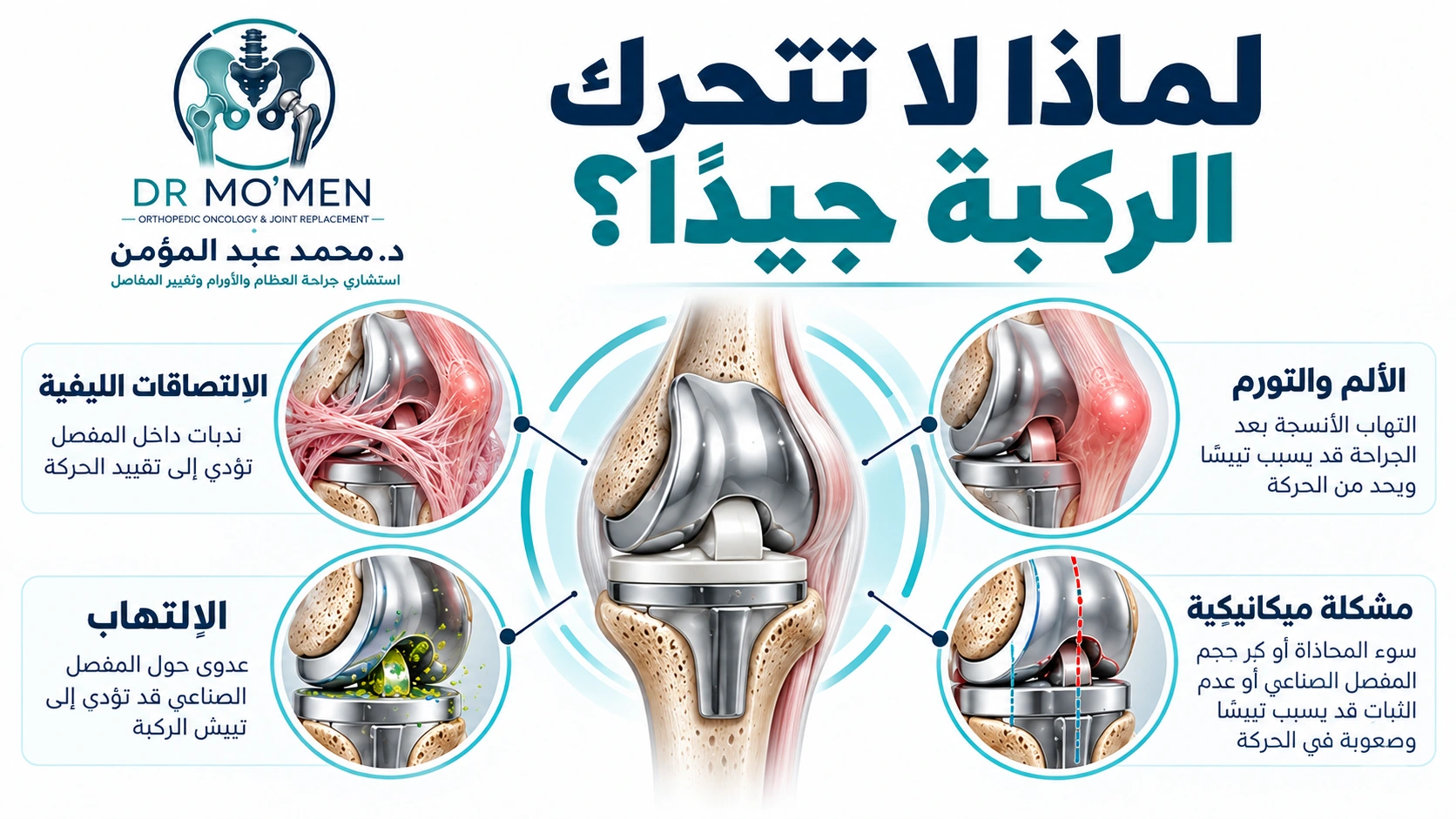 لماذا لا تتحرك الركبة جيدًا؟ إنفوجرافيك طبي يوضح أهم أسباب تيبس الركبة بعد تغيير المفصل.