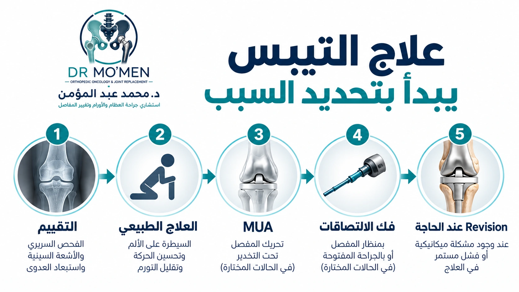 علاج التيبس يبدأ بتحديد السبب إنفوجرافيك يوضح مسار علاج تيبس الركبة من التأهيل إلى MUA وفك الالتصاقات أو Revision.