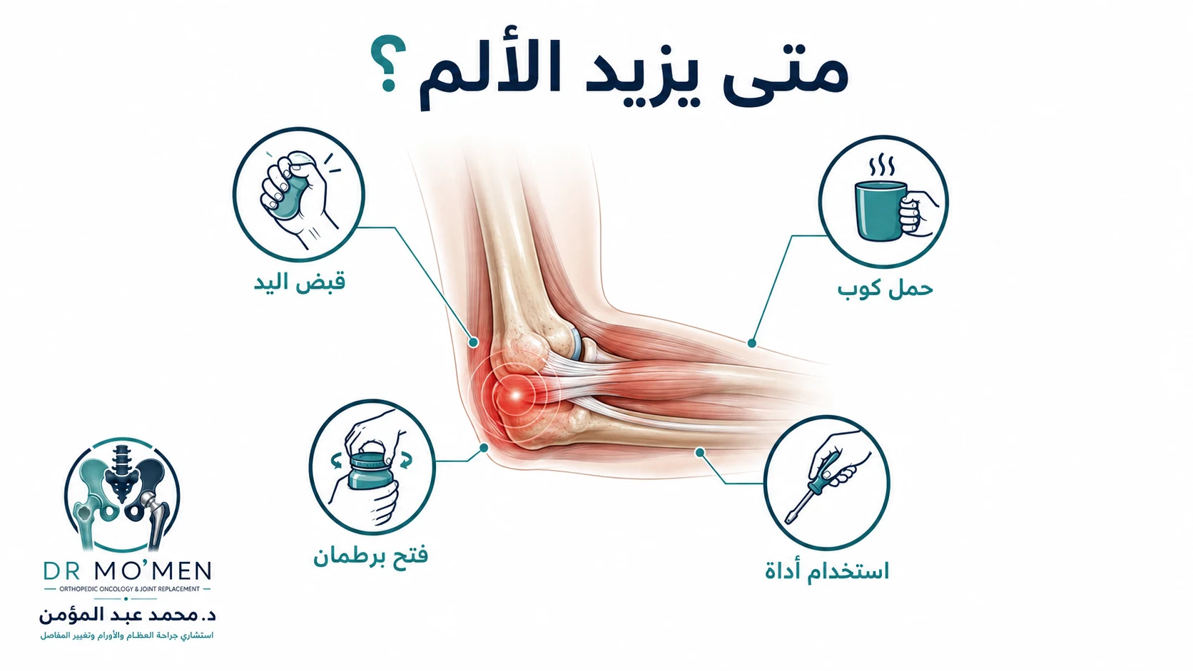 إنفوجرافيك يوضح الأنشطة التي قد تزيد ألم مرفق التنس مثل قبض اليد وحمل كوب وفتح برطمان واستخدام أداة.
