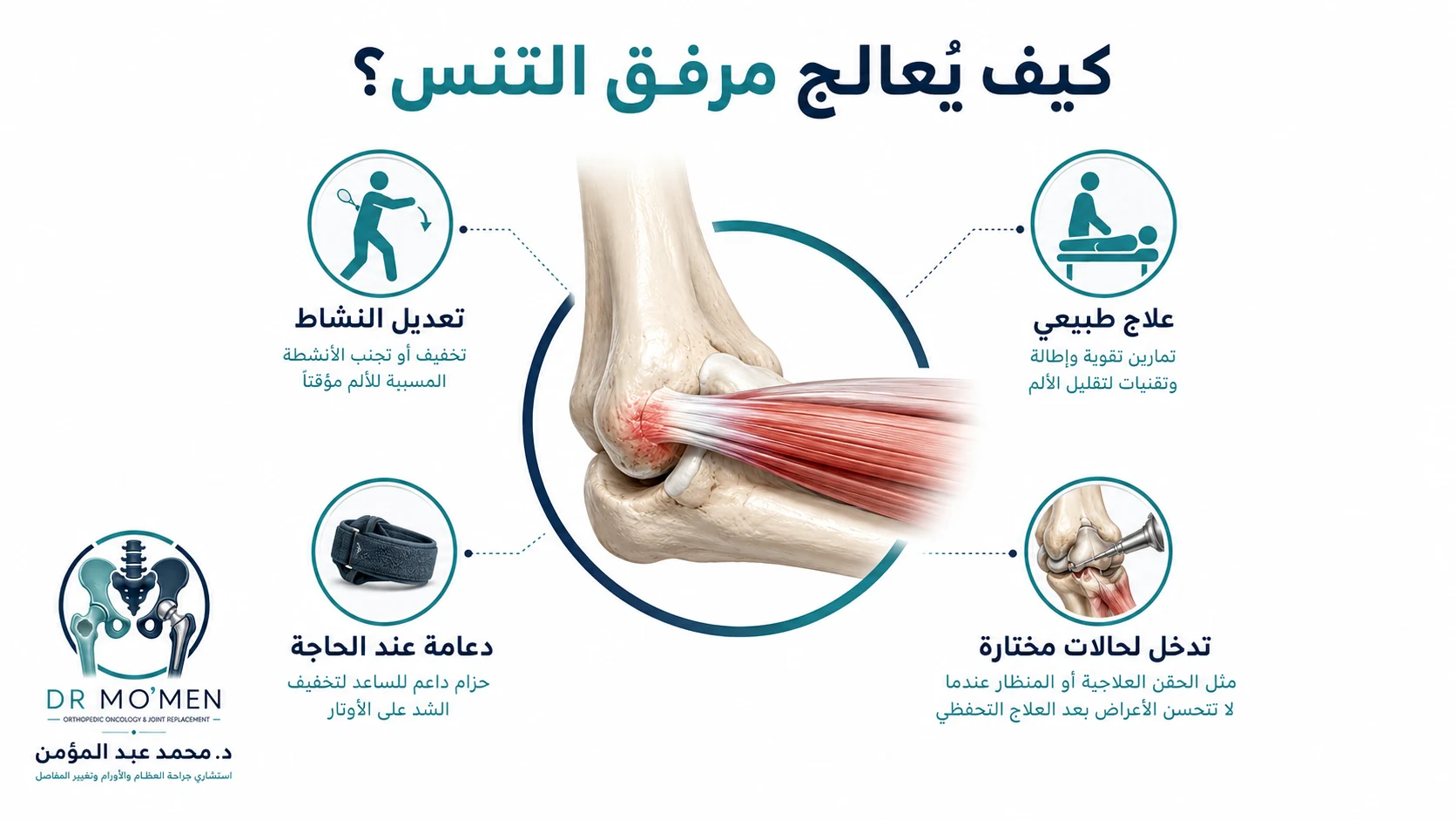 إنفوجرافيك يوضح خيارات علاج مرفق التنس من تعديل النشاط والعلاج الطبيعي والدعامة إلى التدخل في الحالات المختارة.