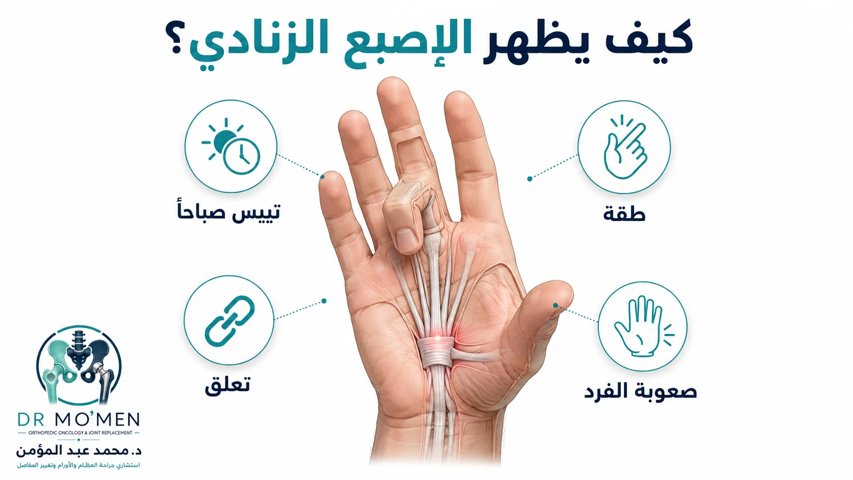 إنفوجرافيك يوضح أعراض الإصبع الزنادي مثل التيبس صباحًا والطقة والتعلق وصعوبة فرد الإصبع.