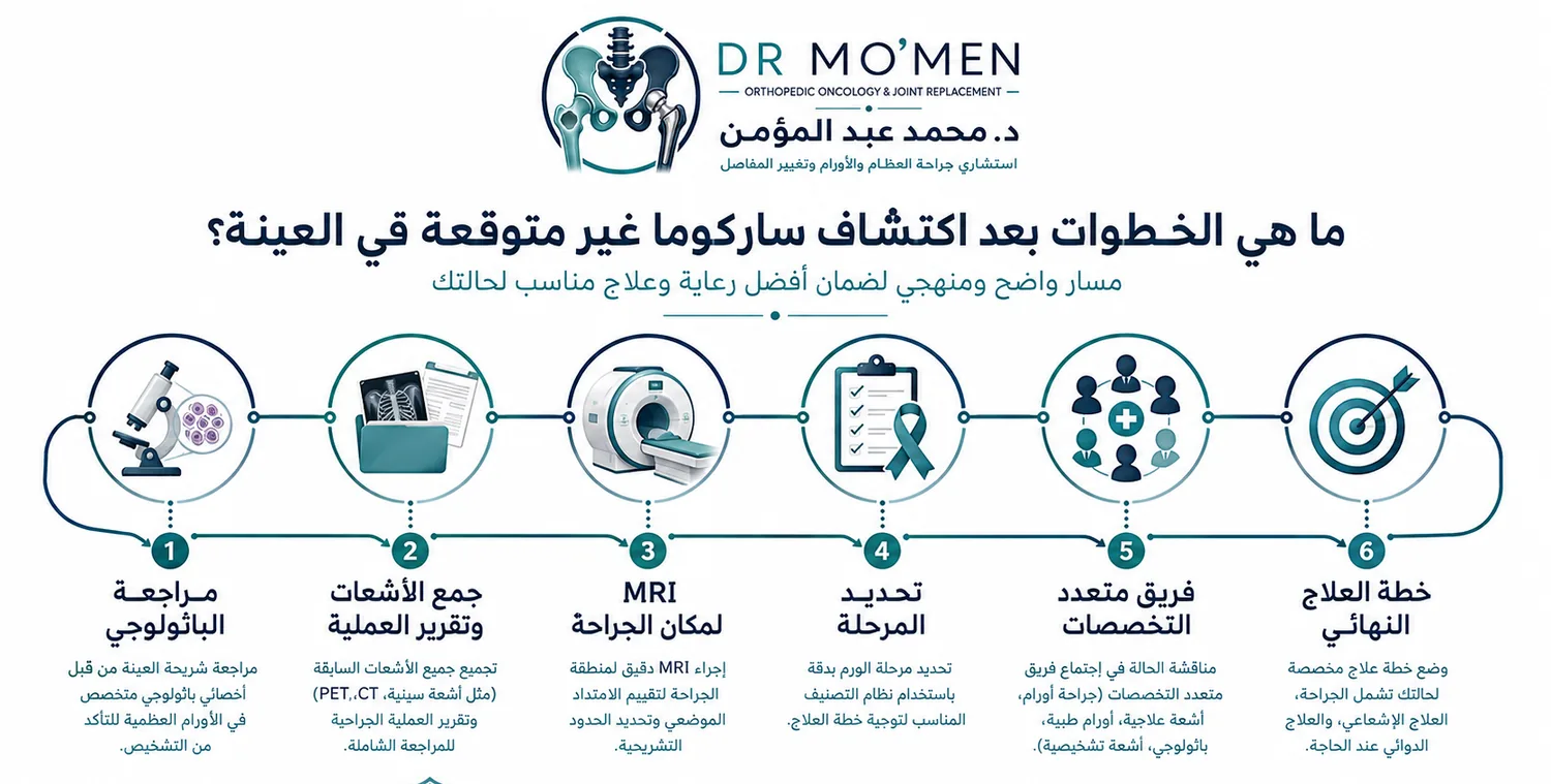 خطوات إعادة تقييم المريض بعد اكتشاف ساركوما الأنسجة الرخوة عقب عملية غير مخططة
