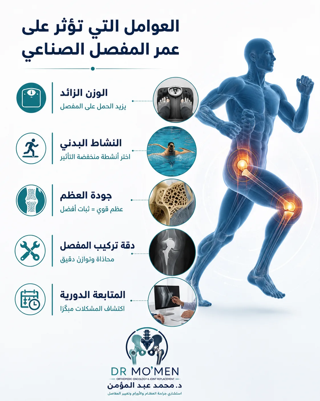 العوامل التي تؤثر على عمر المفصل الصناعي مثل الوزن والنشاط وجودة العظم