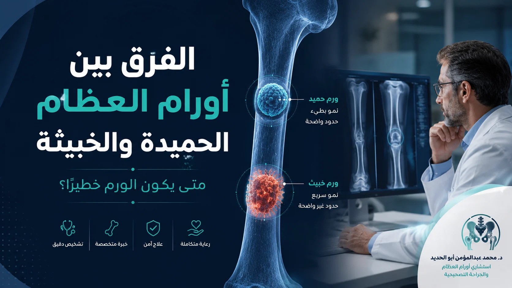 الفرق بين أورام العظام الحميدة والخبيثة مع تقييم متخصص بالأشعة والرنين لدى د. محمد عبدالمؤمن أبو الحديد في مصر الجديدة