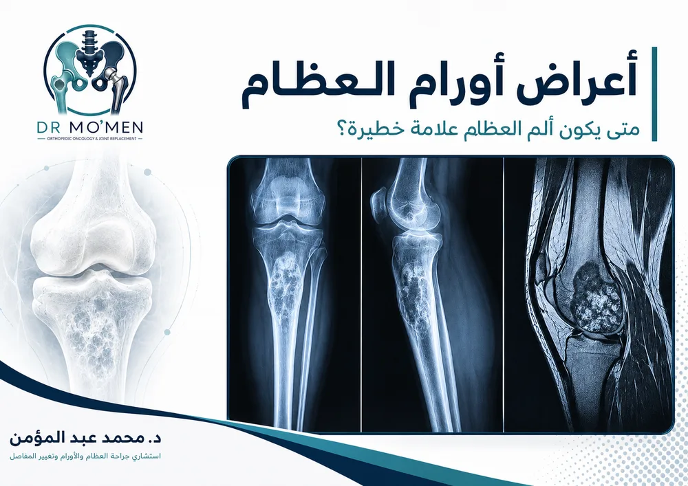 الفرق بين أورام العظام الحميدة والخبيثة: كيف تعرف متى يكون الورم خطيرًا؟