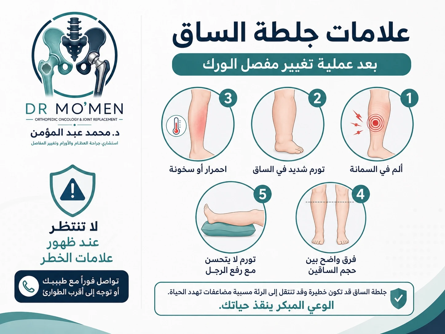 علامات جلطة الساق بعد تغيير مفصل الفخذ مثل ألم السمانة وتورم الساق واحمرارها