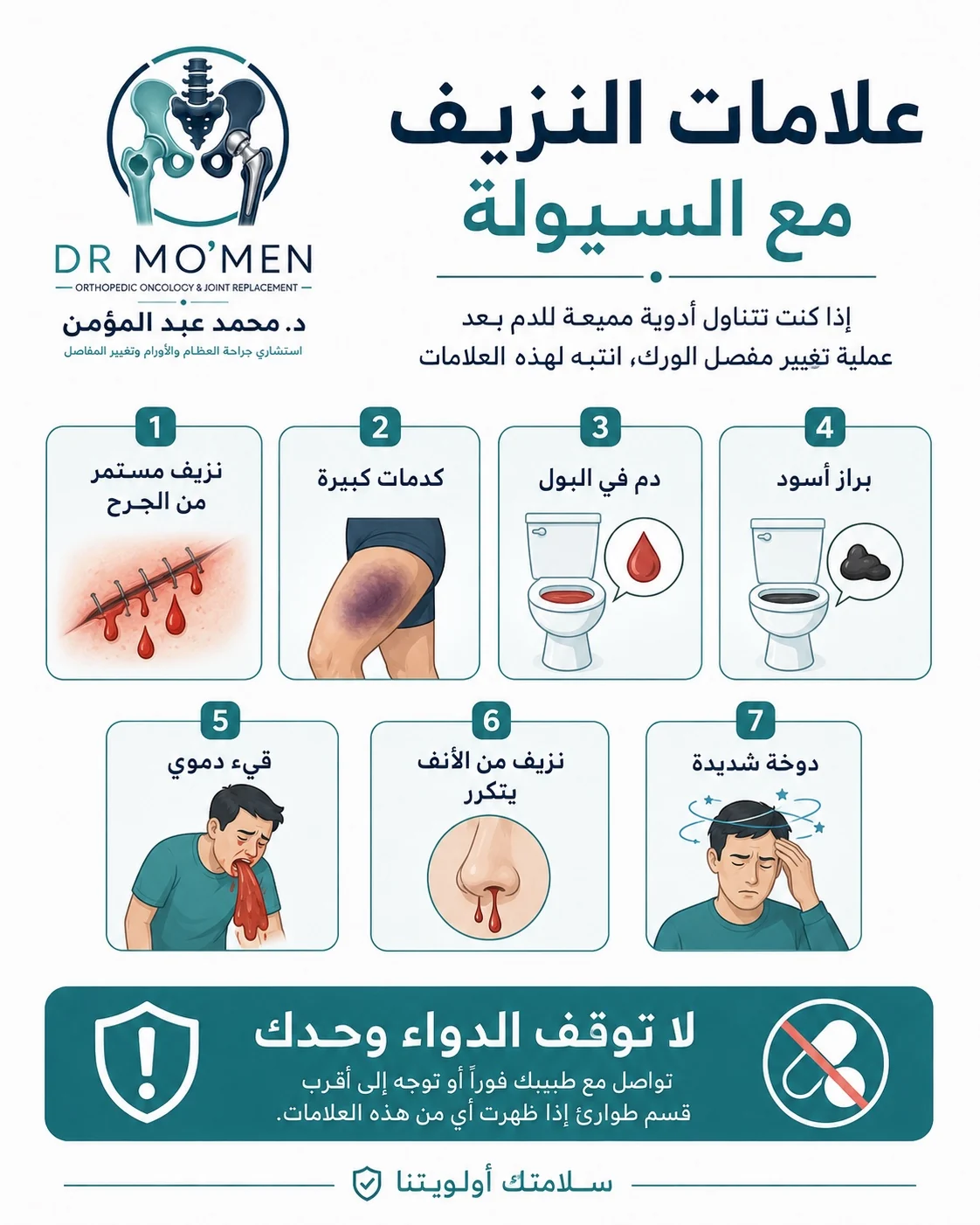 علامات النزيف أثناء استخدام أدوية السيولة بعد تغيير مفصل الفخذ مثل كدمات كبيرة أو دم في البول أو البراز