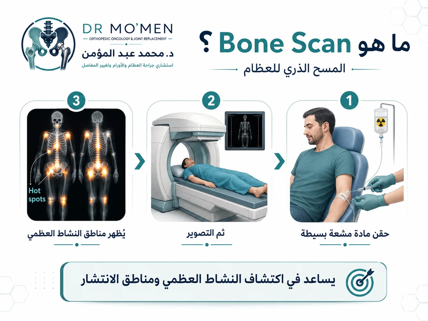 شرح Bone Scan أو المسح الذري للعظام ودوره في اكتشاف النشاط العظمي ومناطق الانتشار