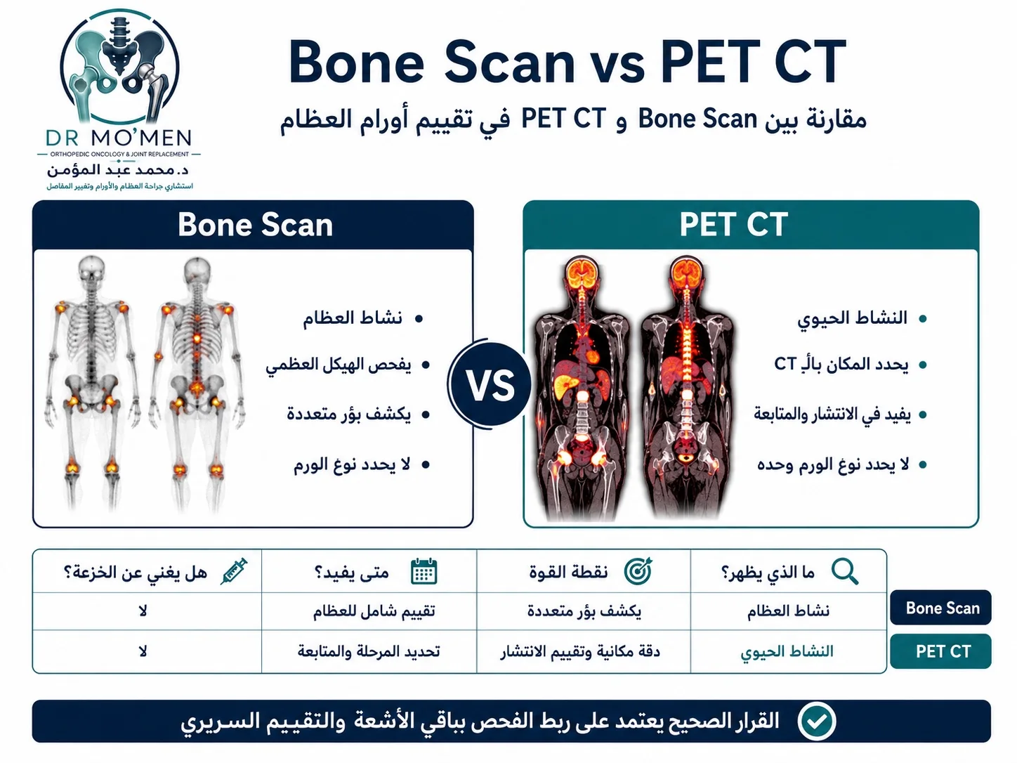 مقارنة بين Bone Scan و PET CT في تشخيص وتقييم انتشار أورام العظام