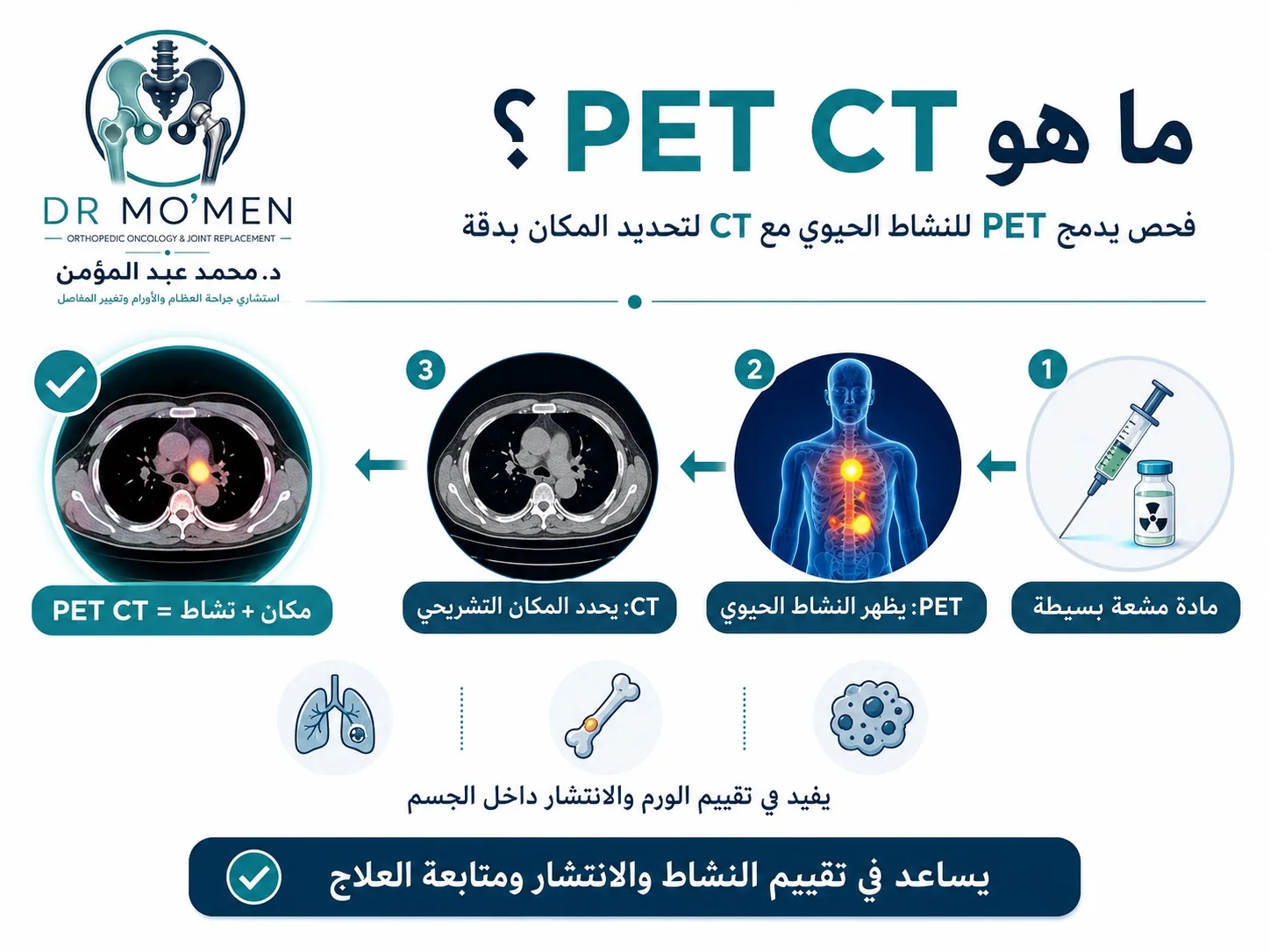 شرح PET CT في أورام العظام ودوره في تقييم النشاط الحيوي والانتشار داخل الجسم