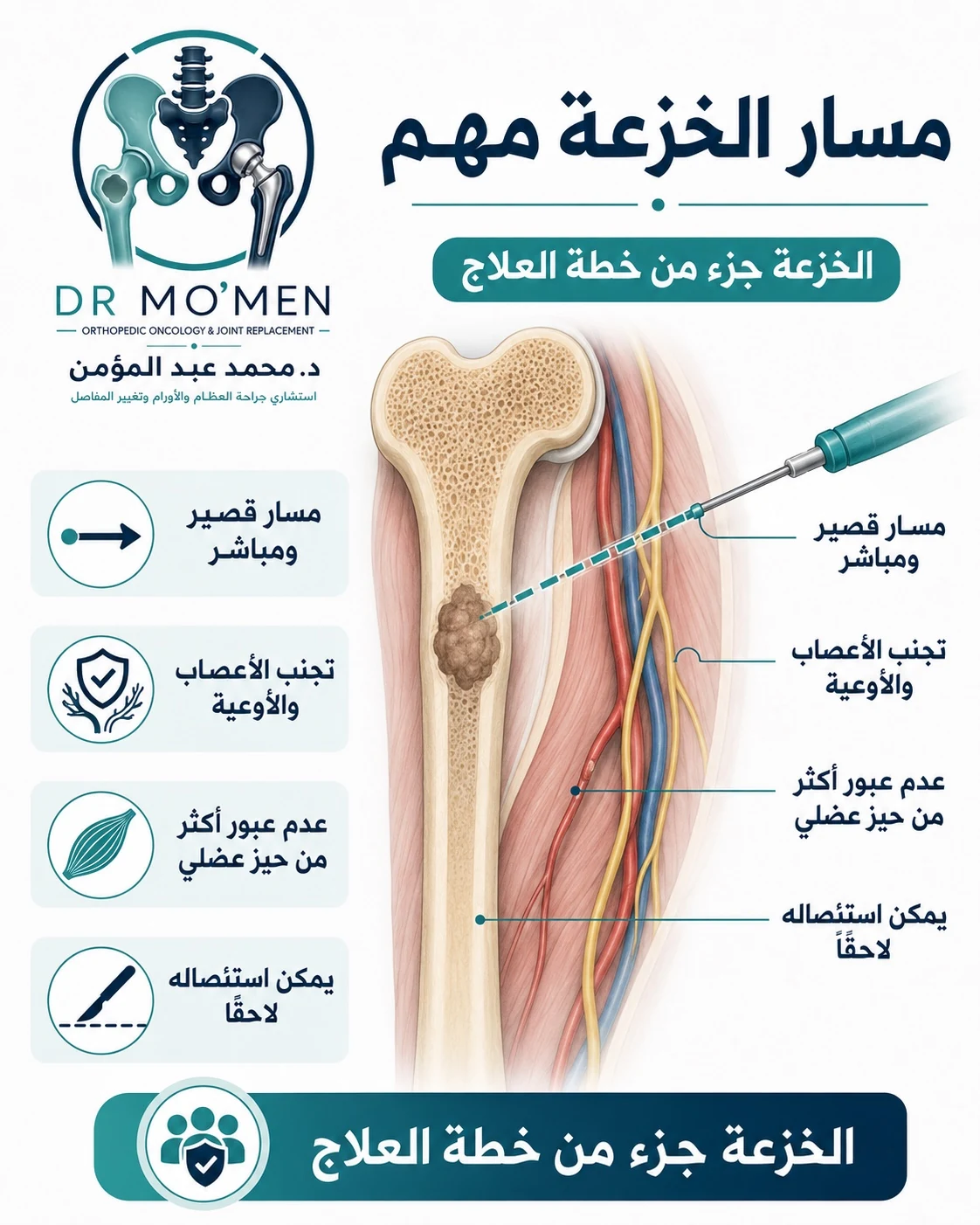 تخطيط مسار خزعة ورم العظام لتجنب تلويث الأنسجة أو التأثير على الجراحة النهائية