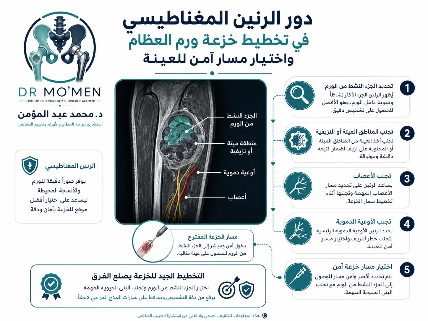 دور الرنين المغناطيسي في تخطيط خزعة ورم العظام واختيار مسار آمن للعينة