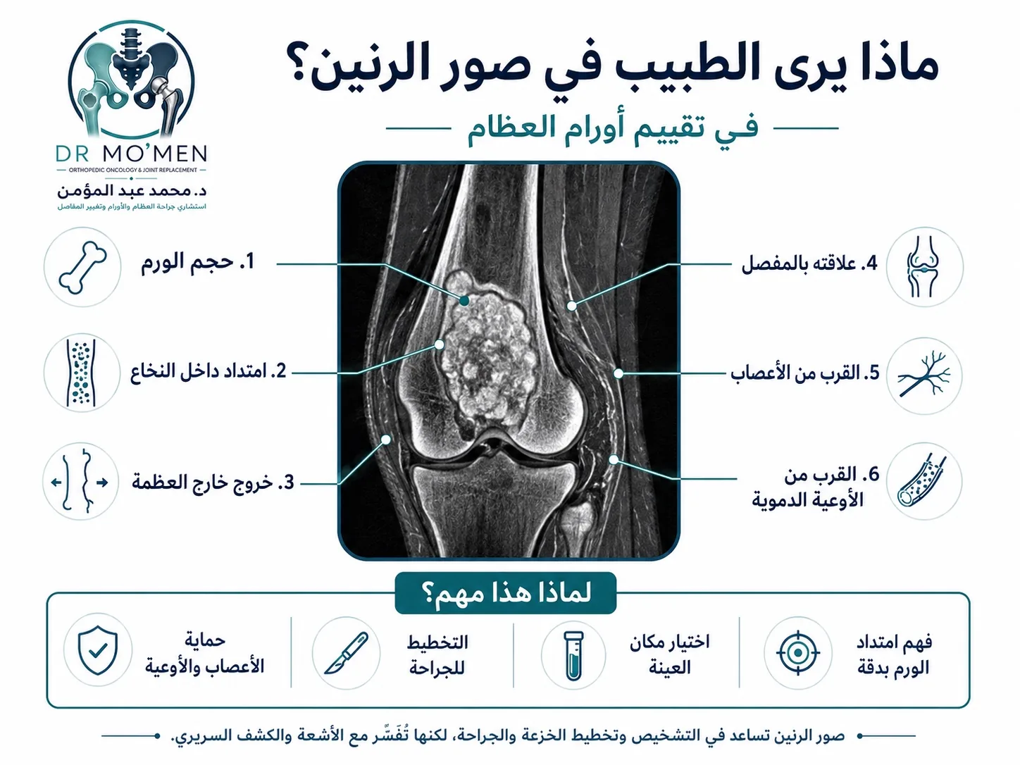ما يراجعه الطبيب في رنين أورام العظام مثل حجم الورم وامتداده وعلاقته بالأعصاب والأوعية