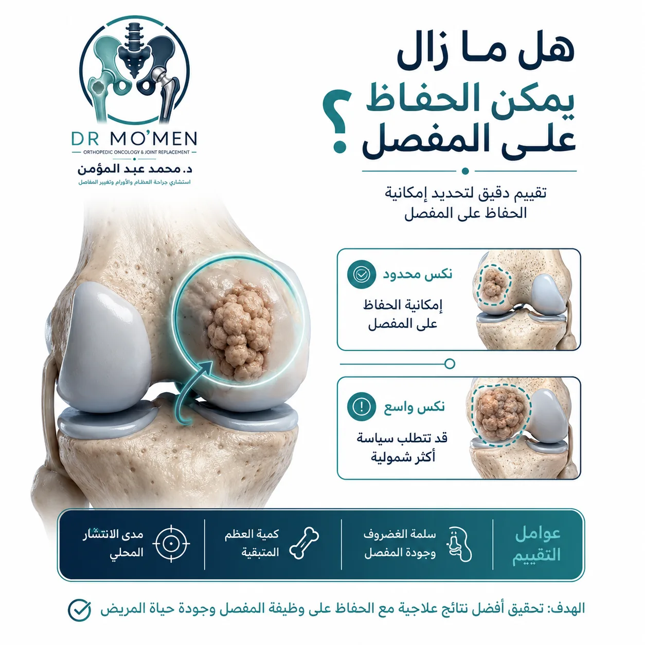 عوامل تقييم إمكانية الحفاظ على المفصل بعد ارتجاع ورم العظام