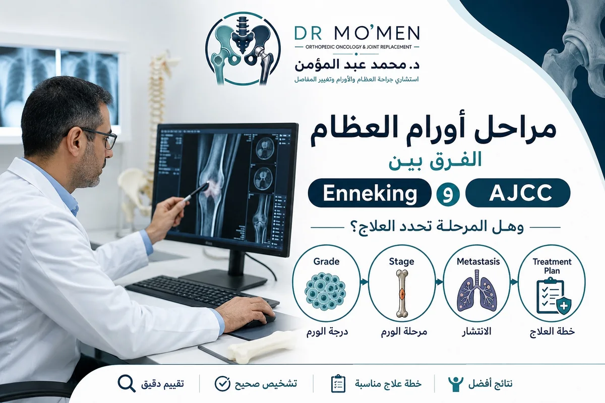 مراحل أورام العظام والفرق بين نظام Enneking ونظام AJCC في تحديد خطة علاج سرطان العظام
