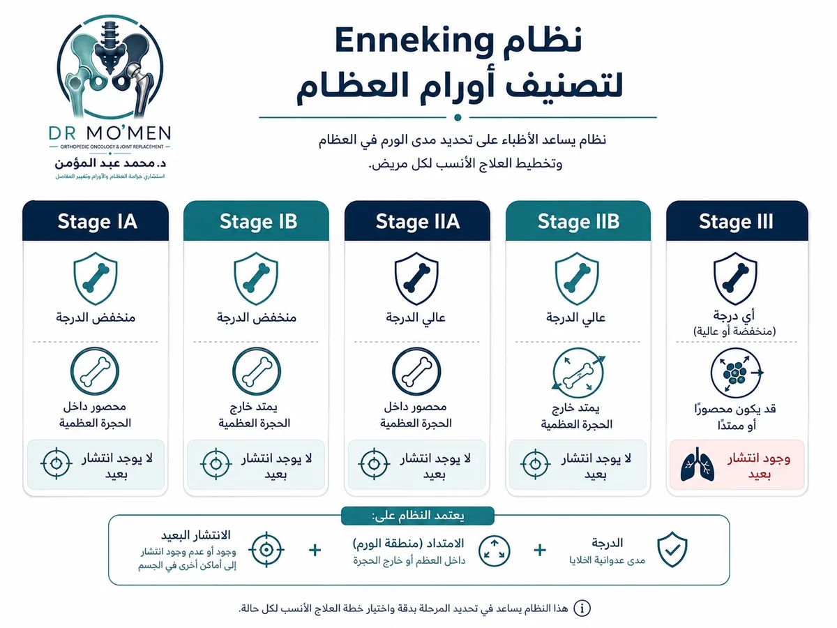 شرح نظام Enneking لتصنيف أورام العظام حسب الدرجة والامتداد والانتشار