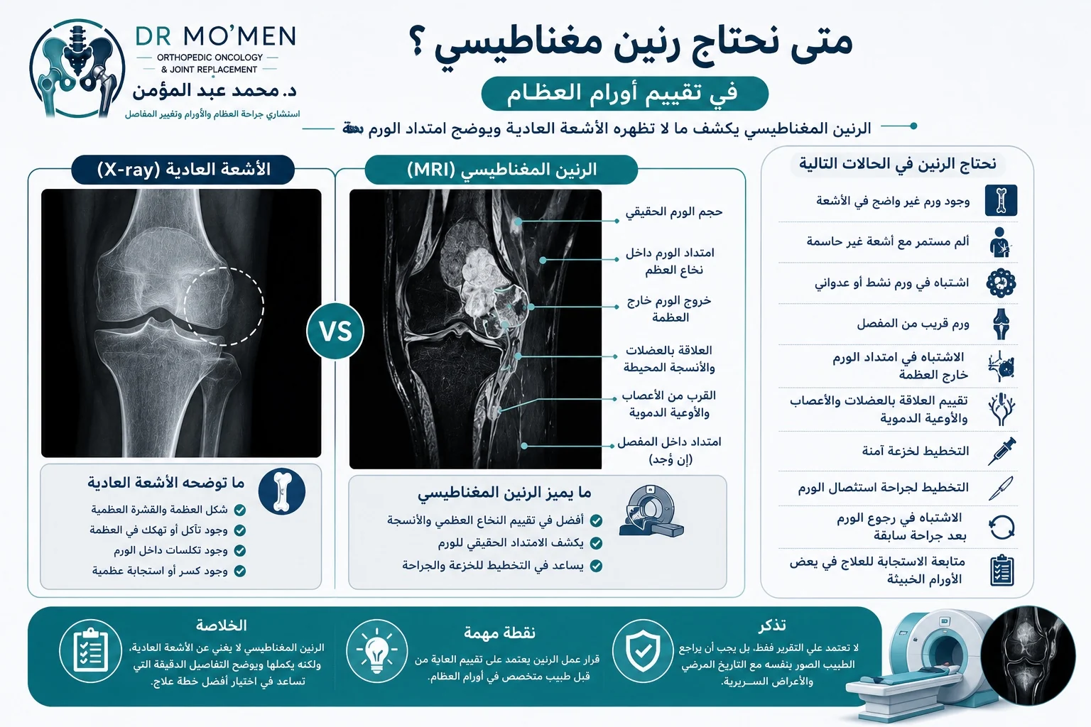 متى نحتاج الرنين المغناطيسي في تقييم أورام العظام وامتداد الورم داخل وخارج العظمة