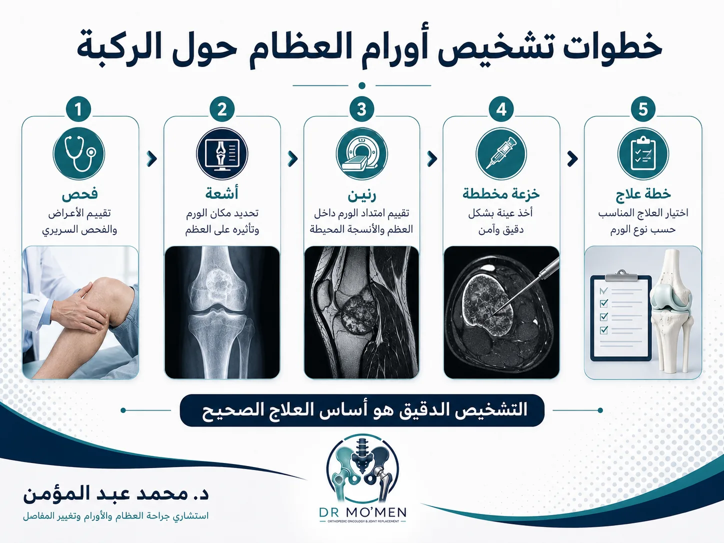 خطوات تشخيص أورام العظام حول الركبة من الفحص والأشعة والرنين إلى الخزعة المخططة وخطة العلاج
