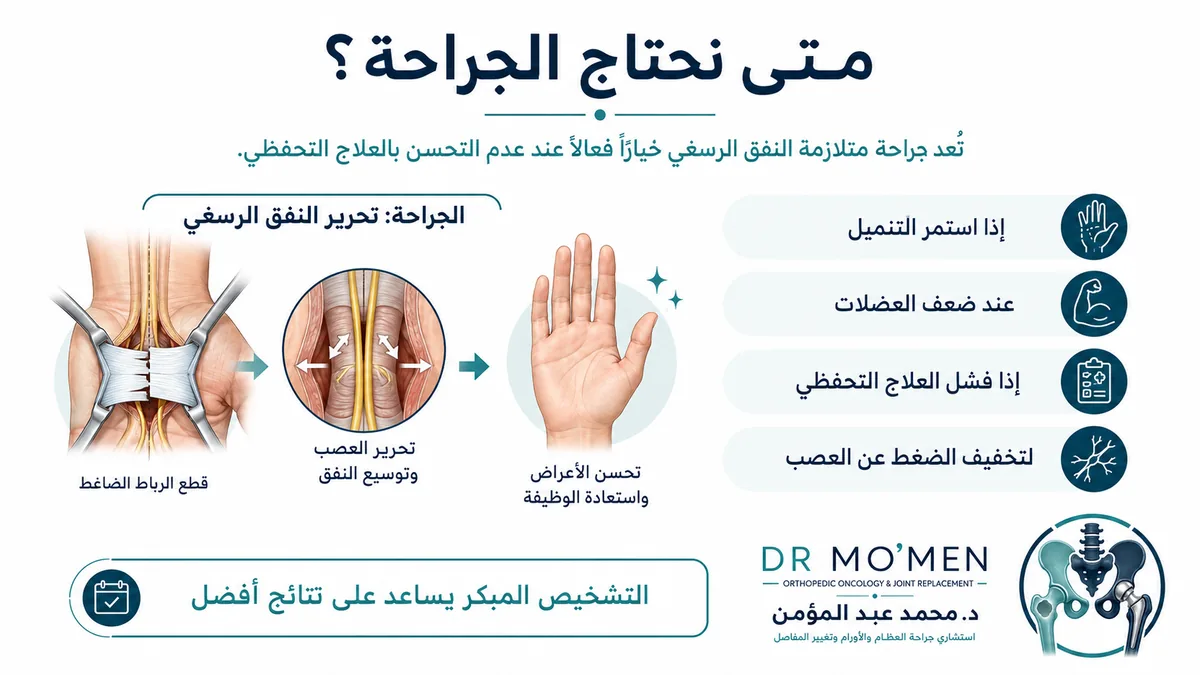 متى نحتاج جراحة تسليك عصب اليد في النفق الرسغي