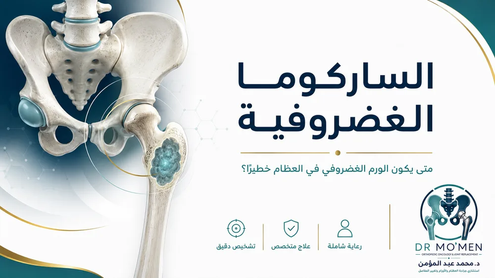 الساركوما الغضروفية Chondrosarcoma — صورة توضيحية داخل المقال رقم 1