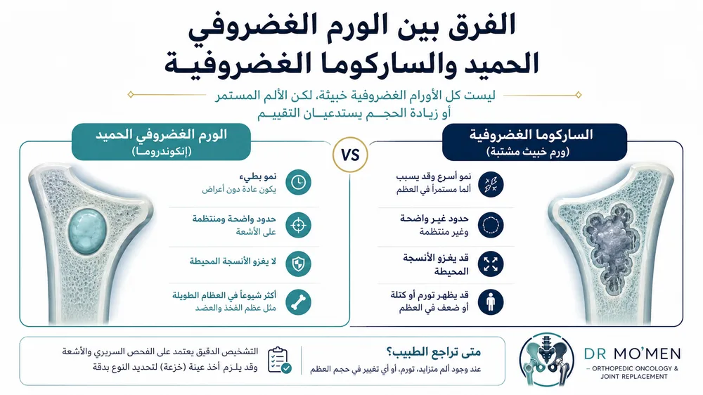الساركوما الغضروفية Chondrosarcoma — صورة توضيحية داخل المقال رقم 2