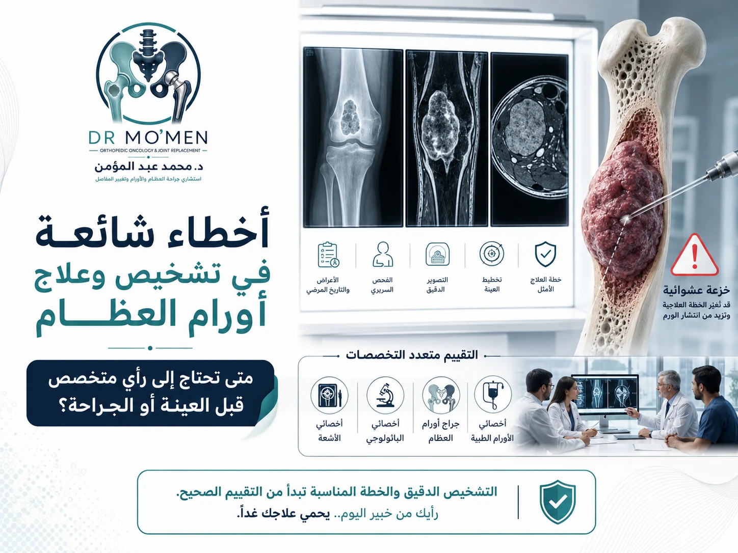 أخطاء تشخيص وعلاج أورام العظام