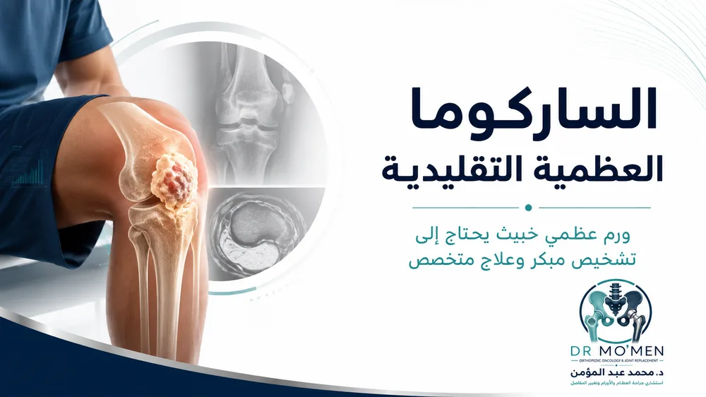 الساركوما العظمية التقليدية — صورة توضيحية داخل المقال رقم 1