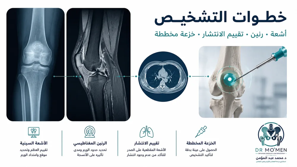 الساركوما العظمية التقليدية — صورة توضيحية داخل المقال رقم 3