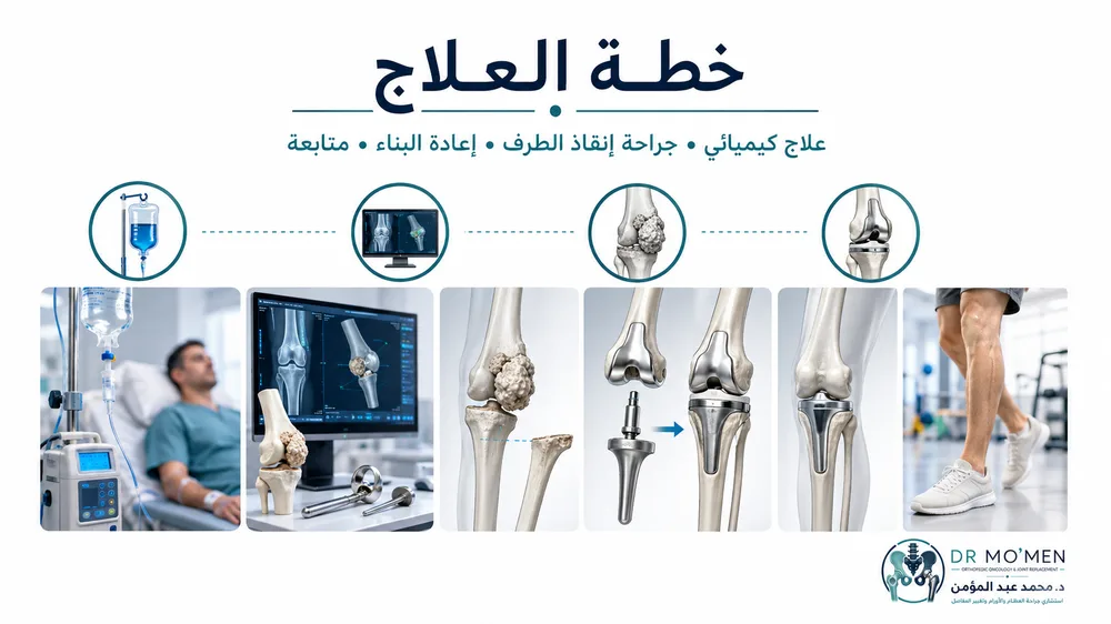 الساركوما العظمية التقليدية — صورة توضيحية داخل المقال رقم 4