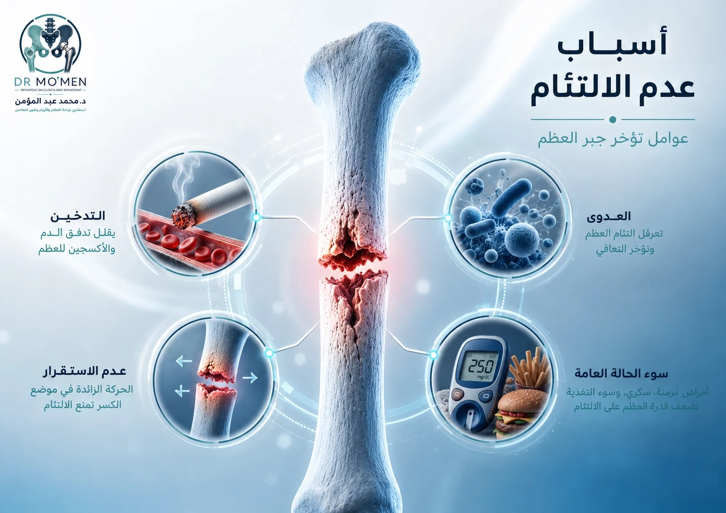 رسم توضيحي يشرح أسباب عدم التئام العظام مثل التدخين والعدوى وعدم الاستقرار وسوء الحالة العامة
